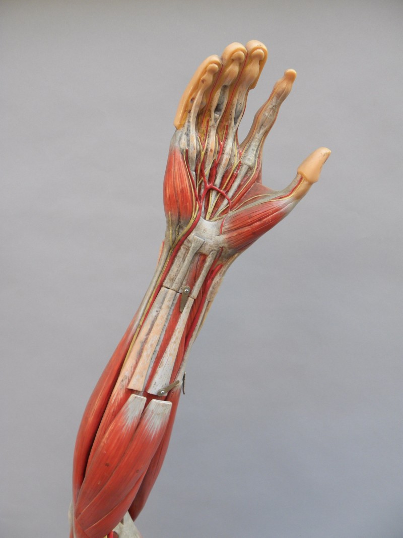 German anatomical model of the arm by Somso Fleaglass