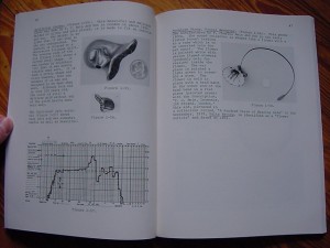 HISTORIC DEVICES FOR HEARING - The CID-Goldstein Collection