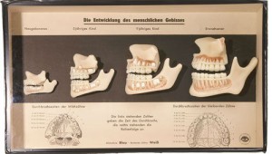 gebitsontwikkeling