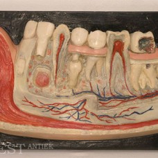 A BOCK STEGER DIDACTIONAL MODEL OF THE JAW