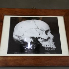 Antique early 20th century skull photograph