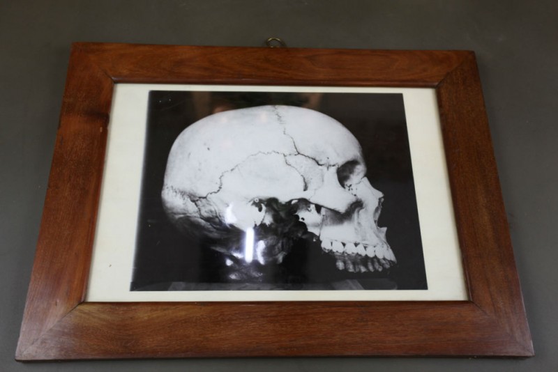 Antique early 20th century skull photograph
