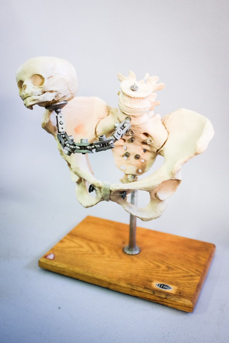 Obstetrical model: skeleton of the female pelvis with fetus skull