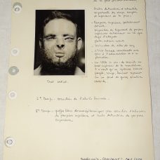 A medical French medical dossier about a face reconstruction via plastic surgery