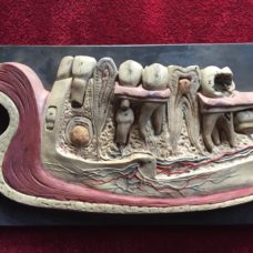 German anatomical model of the teeth, late 1800’s