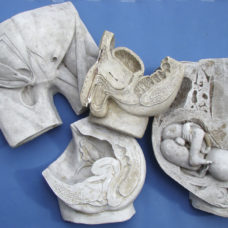HUMAN REPRODUCTION IN PLASTER:  SET OF ANATOMICAL MODELS