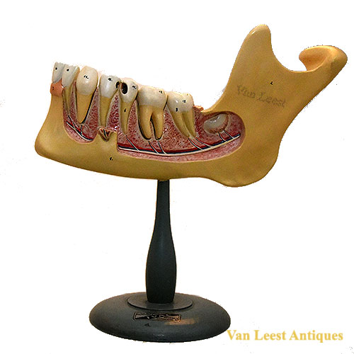 Anatomical lower jaw model, Somso