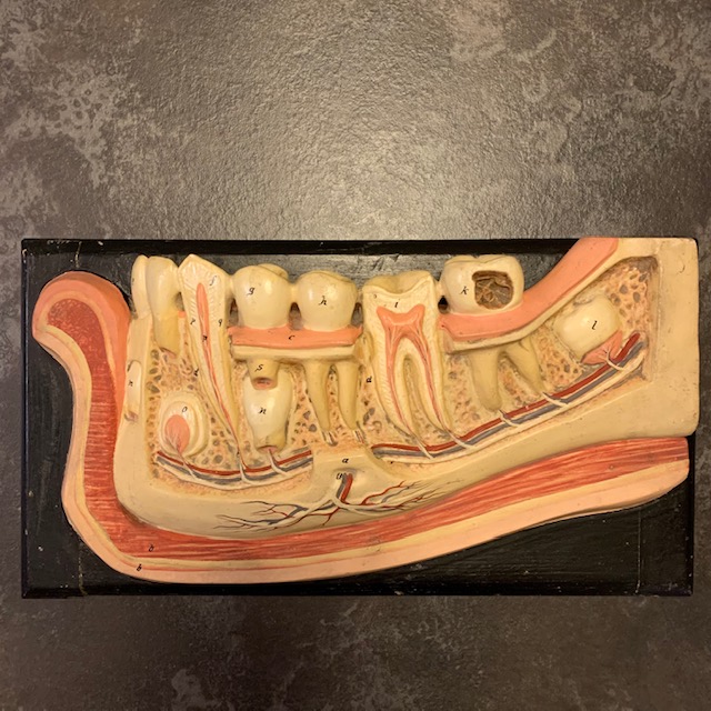 Italian teaching model of the teeth, papier mache, late 1800’s