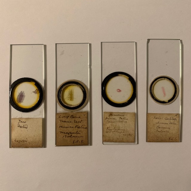 4 antique microscope slides, Human fetus, late 1800’s