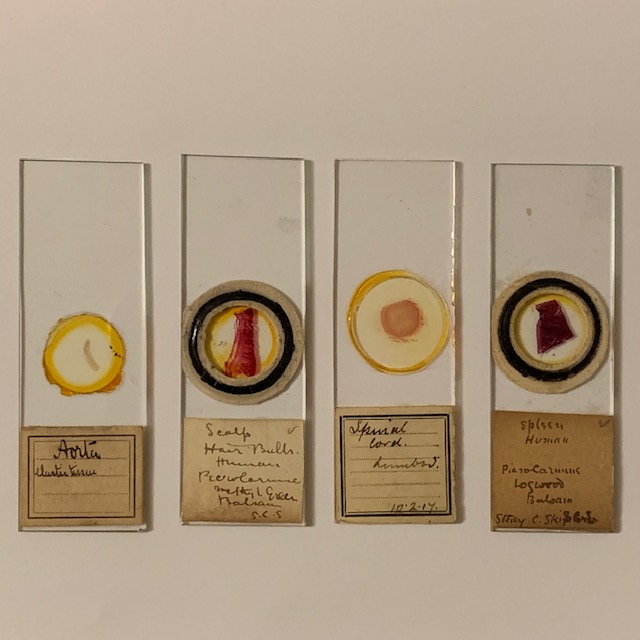 4 antique microscope slides, human specimen – aorta, scalp,., late 1800’s