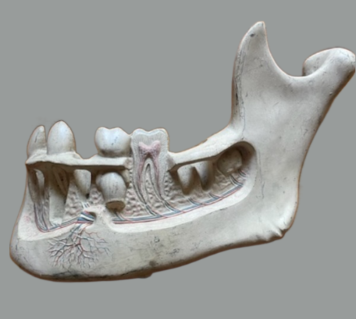 DENTAL “ECORCHÉ” PLASTER PAINTED 19TH CENTURY