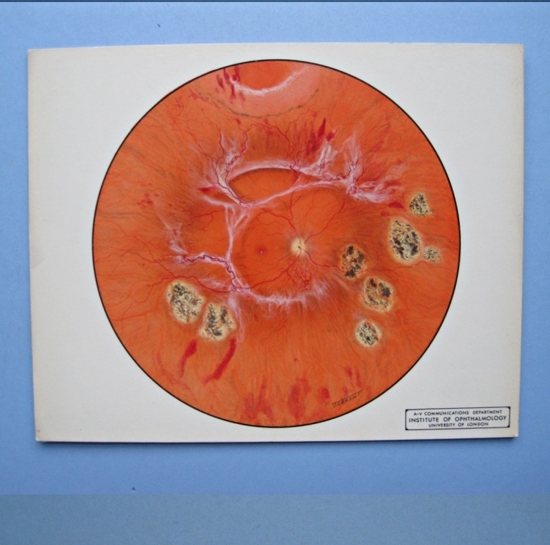 Terrence Tarrant Original Retinal Drawings