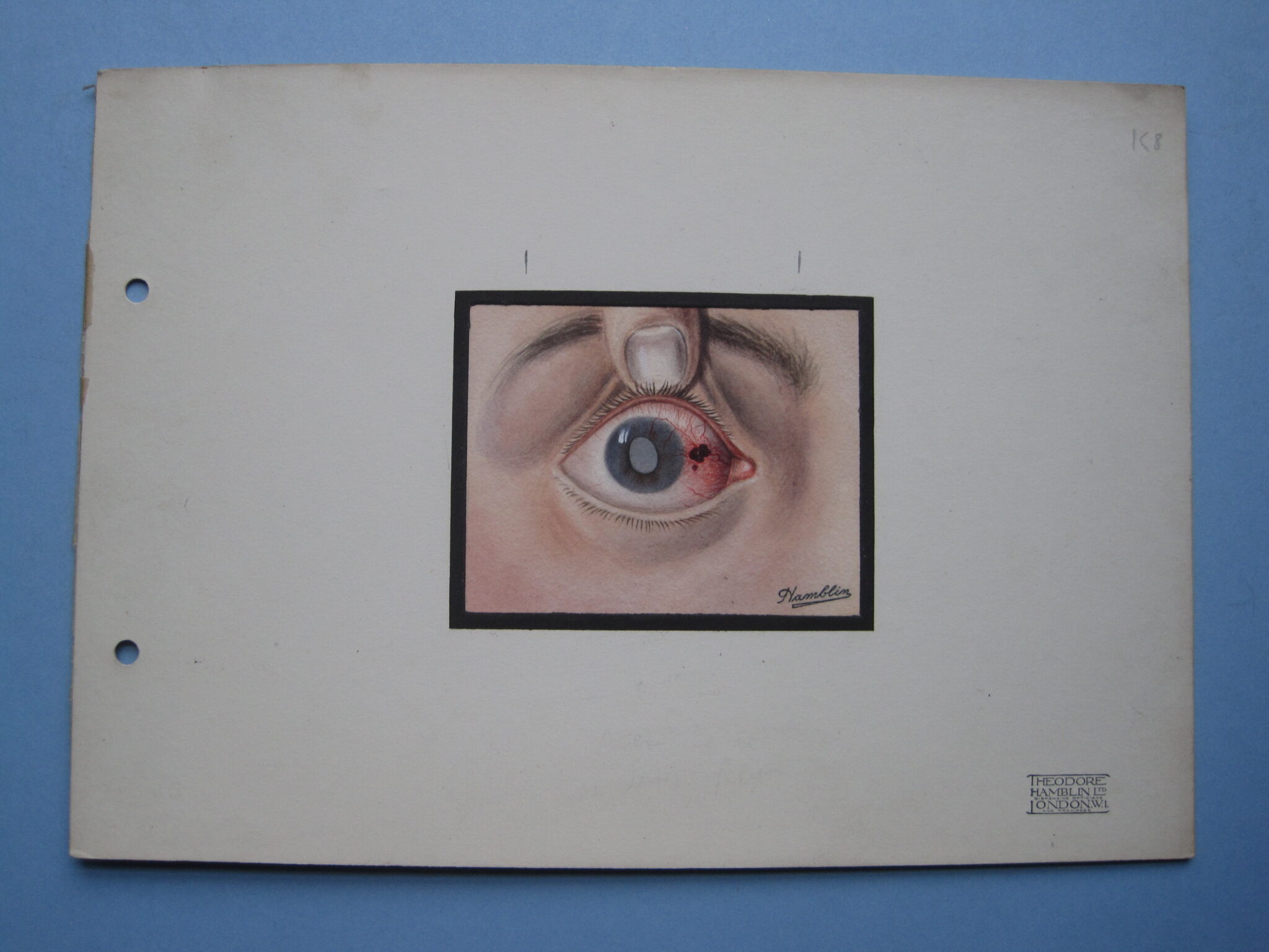 1920s Medical Drawings of Ophthalmic Pathologies