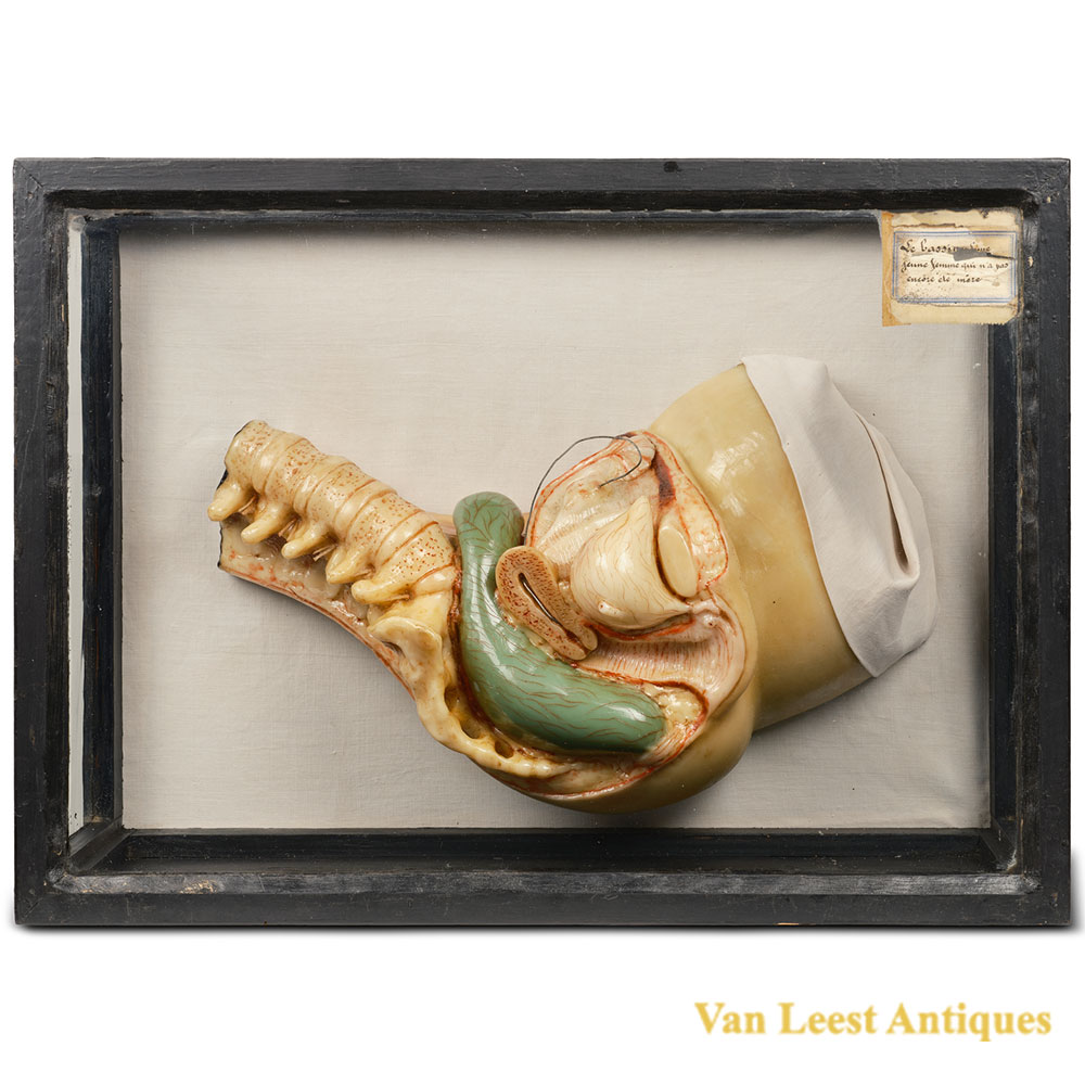 Talrich wax model Pelvis of a well-formed young woman Case A
