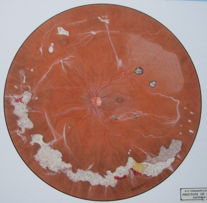 Terrence Tarrant Original Retinal Drawing