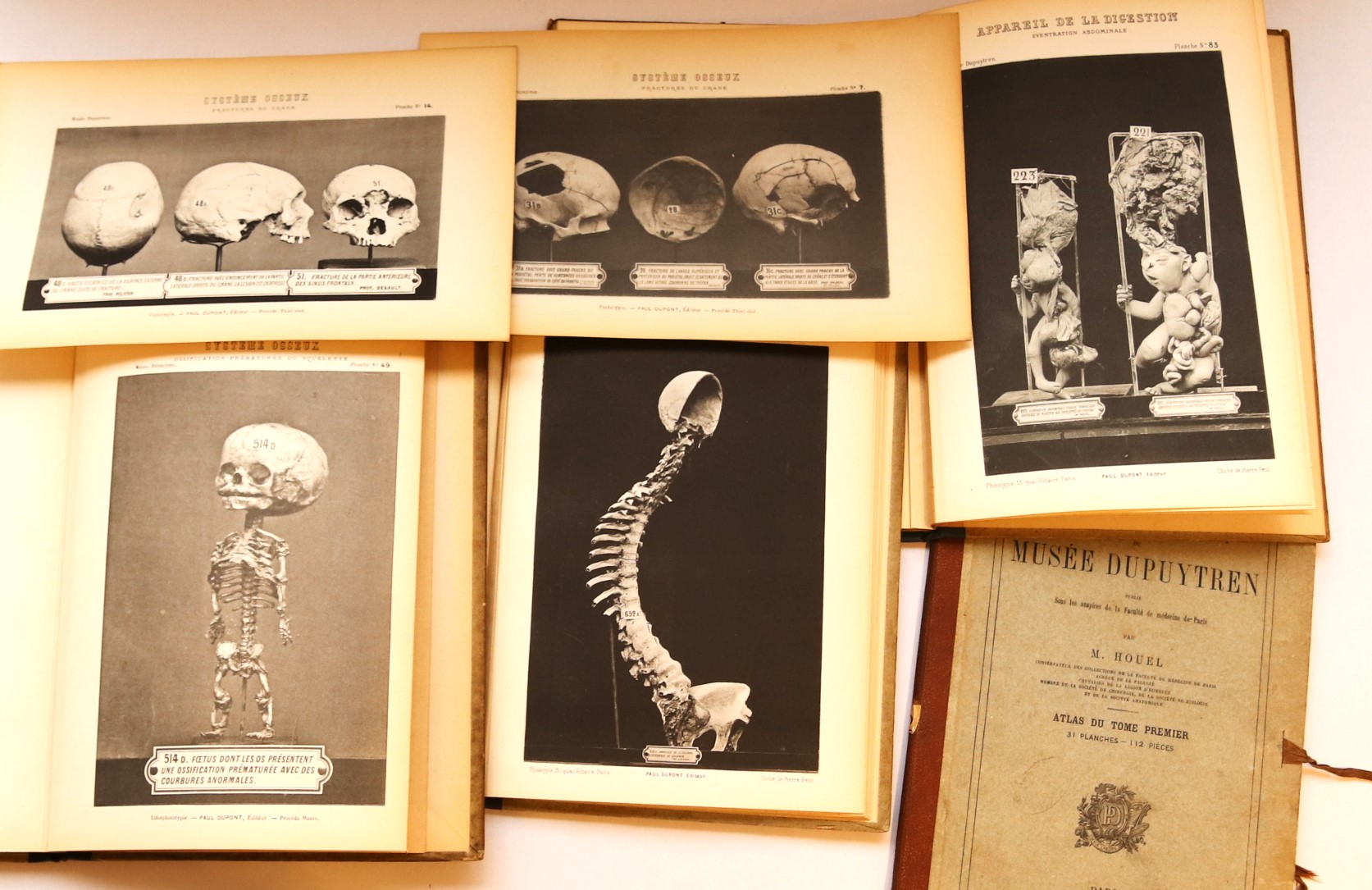 The scarce illustrated catalogue of the Dupuytren’s pathological anatomy Museum in Paris, 1877-1879