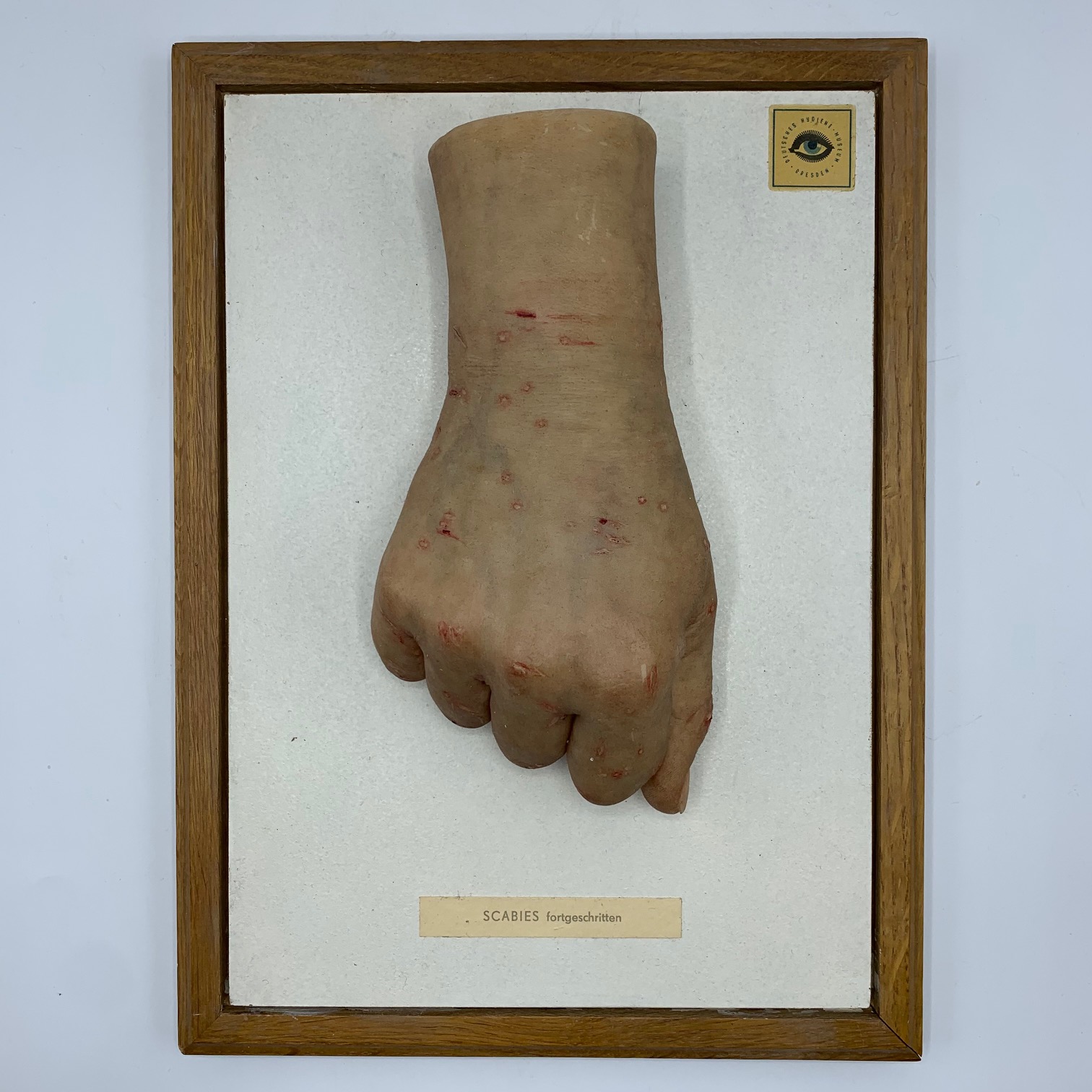 Anatomical wax model by the German maker Hygiene Museum of Dresden, scabies