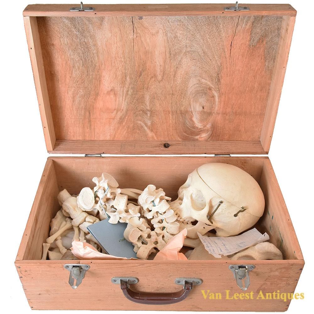 Half-Skeleton Bone Box, 1979