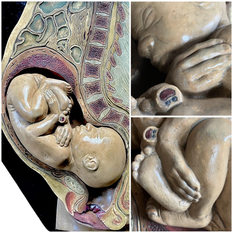 Obstetrical anatomical model, German, possibly Bock-Steger