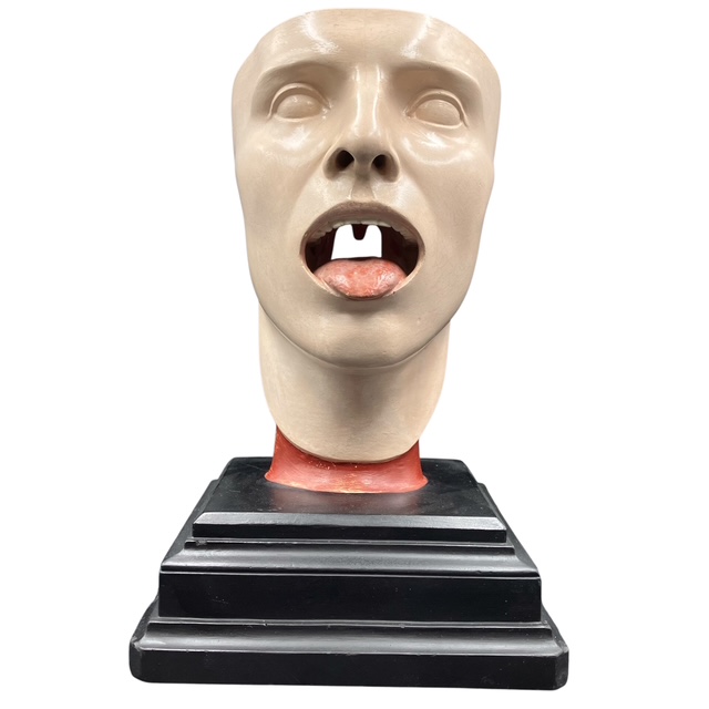 A German anatomical model of the larynx, by Bock-Steger